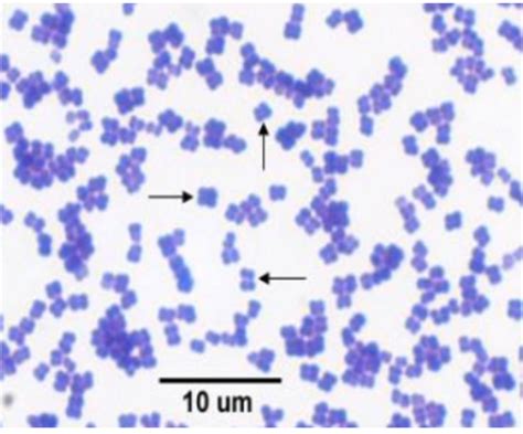 mycobacterium smegmatis|mycobacterium smegmatis arrangement.